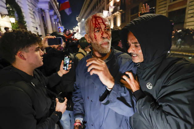 Demonstration against the Italian government in Rome ROME, ITALY, OCTOBER 24: (EDITOR S NOTE: Image depicts graphic content) A protester is seen after been wounded during clashes between Italian police and demonstrators against the Italian government in Rome, Italy, on October 24, 2026. Riccardo De Luca Anadolu Rome Italy. Editorial use only. Please get in touch for any other usage.  Copyright: x2026xAnadoluxRiccardoxDexLucax
